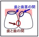 �n�~�K�L�|�C���g
